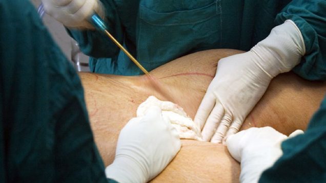 LPS_Channel_Fat_Header