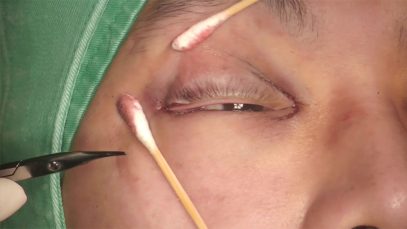 Video3_開眼尾_Pic