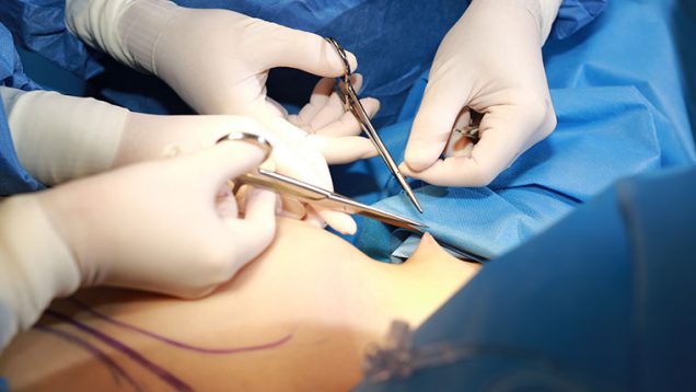 LPS_Channel_Breast_Header