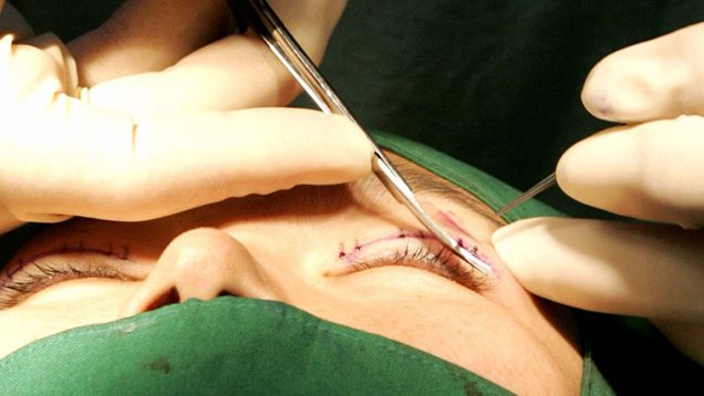 LPS_Channel_Eyelid_Header